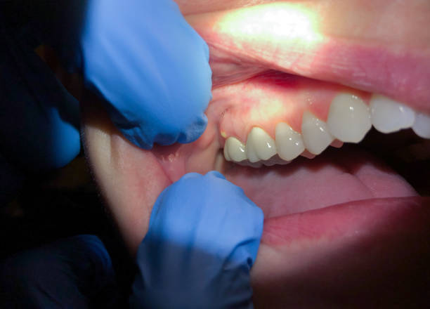 Best Pediatric Emergency Dentist in Baxter Springs, KS
